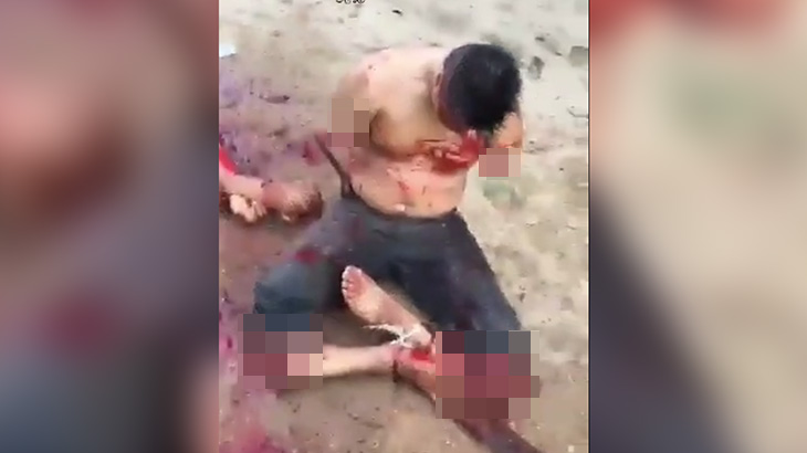 【閲覧注意】両腕両脚を切断されてもがき苦しむ男のグロ動画･･･。