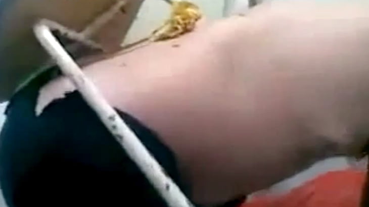 【衝撃映像】椅子が刺さってしまった男 in ロシア。