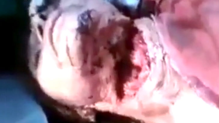 【閲覧注意】首が大きく切り開かれてしまった女性･･･。