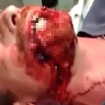 【閲覧注意】口が?壊されてしまった男のグロ動画･･･。