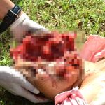 【超！閲覧注意】9階から転落した女性、頭が割れてしまう･･･。