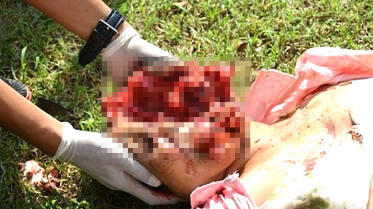 【超！閲覧注意】9階から転落した女性、頭が割れてしまう･･･。