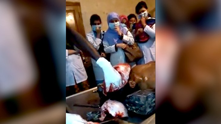 【閲覧注意】検死解剖の映像。男性の死体から脳を取り出すグロ動画。