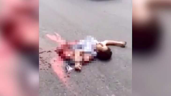 【閲覧注意】事故で身体が真っ二つになった女性、まだ頭が動いてる･･･。