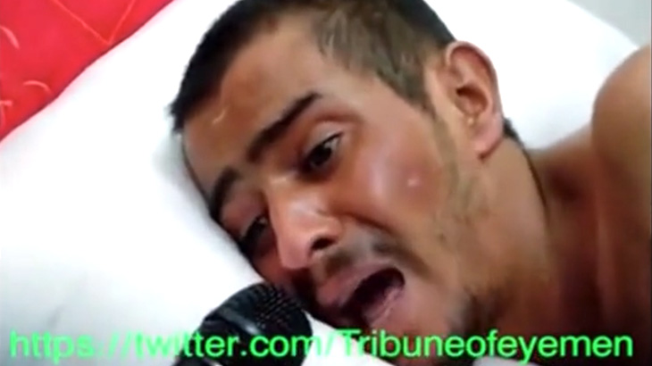 【衝撃映像】左足を負傷して苦しむ男性にインタビューする映像。