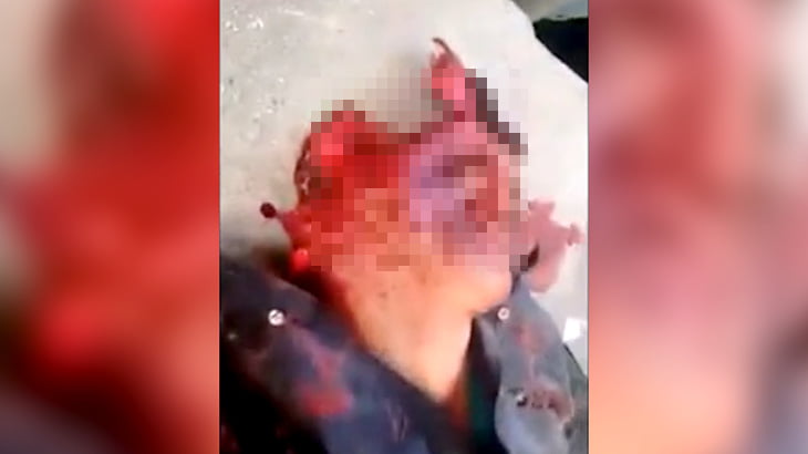 【閲覧注意】襲撃されて殺された男の顔、まるでホラーマスクのようになってしまう･･･。