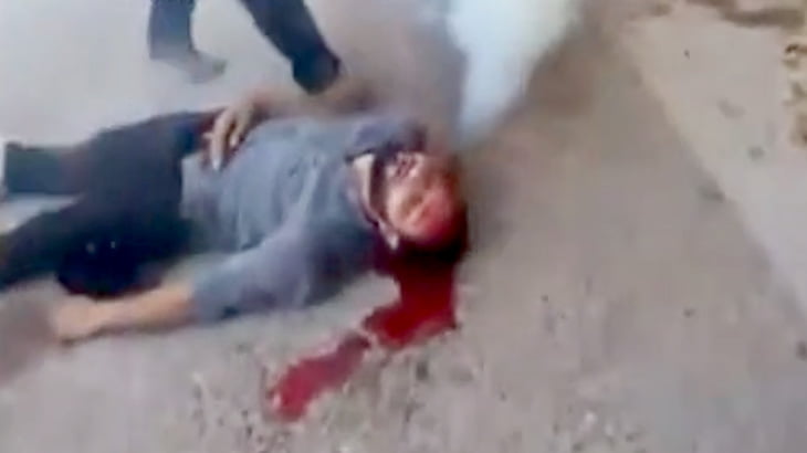 【衝撃映像】催涙弾が頭に刺さってしまった男性･･･。