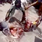 【閲覧注意】事故で上半身と下半身がほぼ切断されてしまった男のグロ動画･･･。