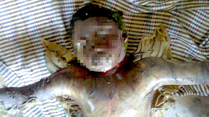 【閲覧注意】死んで数日経ちガスでパンパンに腫れ上がった死体を撮影したグロ画像集。