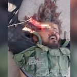 【閲覧注意】頭を撃ち抜かれて死んだ兵士の顔、ヤバすぎる･･･。