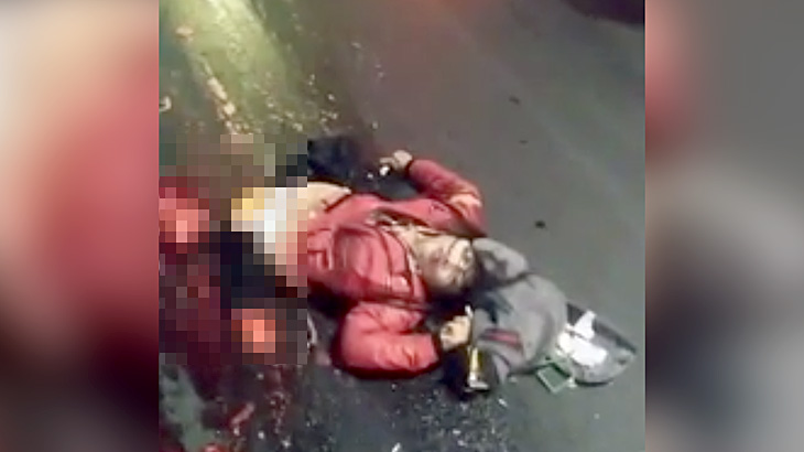 【閲覧注意】バイクに乗っていた女性、事故で下半身が引き裂かれてしまったグロ動画･･･。