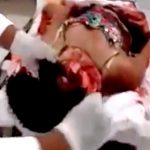 【閲覧注意】遺体安置所に届いた事故で死んだ女性の死体、グチャグチャ･･･。