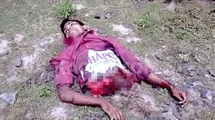 【閲覧注意】列車に腰から下を切断されてしまった男性のグロ動画。