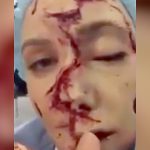 【閲覧注意】顔の皮膚を縦に半分に切られてしまった女性のグロ動画。