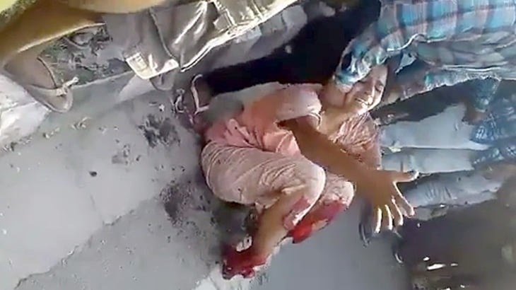 【閲覧注意】列車に両足首を切断されてしまった女性のグロ動画。