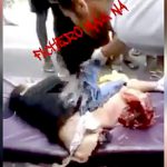 【閲覧注意】トラックに胴体を引き裂かれ腸が飛び出した女性のグロ動画。