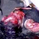 【閲覧注意】車に轢かれて顔が無くなってしまった女性のグロ動画･･･。