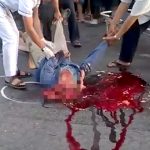 【閲覧注意】事故現場にうつ伏せになって死亡した男性を裏返したら顔が破壊されてたグロ動画･･･。