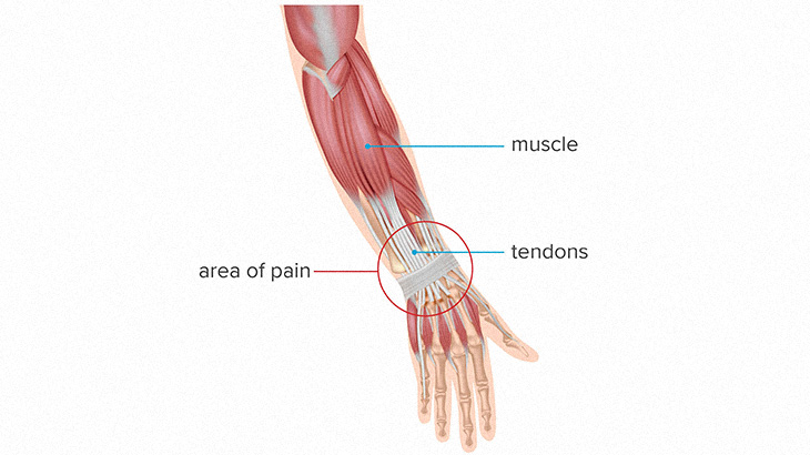 【閲覧注意】手首の腱が丸見えになってしまったグロ動画。