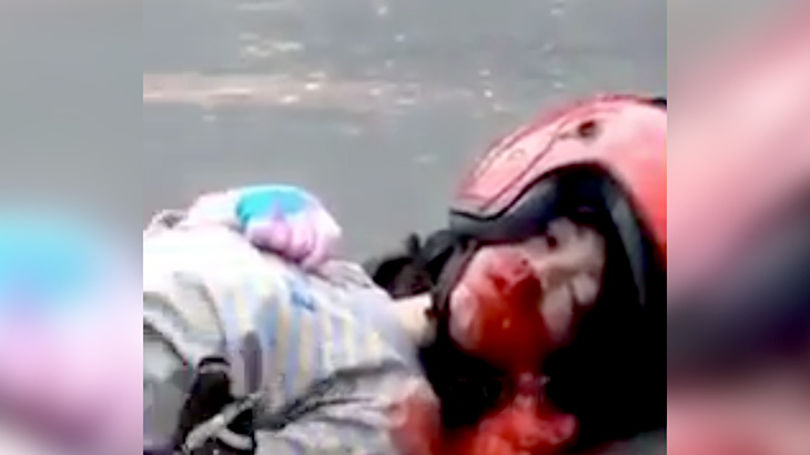 【閲覧注意】バイク事故で大量の血を流す女の子、もうすぐ死ぬ･･･。