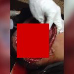 【閲覧注意】マチェーテで頭の側面を切られて頭蓋骨が見えてしまっている男性のグロ動画。