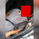 【閲覧注意】事故でクラッシュした車を運転していたドライバーの顔、半分無くなってしまったグロ動画。