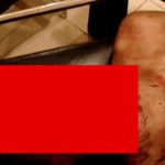 【閲覧注意】マチェーテで顔と首を切られたものの生き延びた男性のグロ動画。