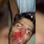 【閲覧注意】マチェーテで鼻と上唇をスライスされてしまった男のグロ動画。