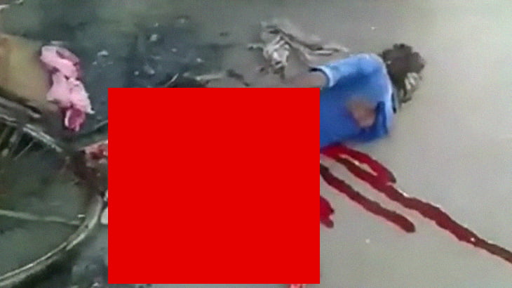 【閲覧注意】トラックに轢かれた男性、生き延びたが下半身がグチャグチャになってしまったグロ動画。