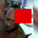 【閲覧注意】マチェーテで襲われた男、頭皮がベロンとめくれてしまったグロ動画。