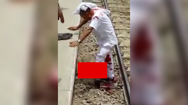 【閲覧注意】列車に轢かれて左足首を切断されるも生き延びた男性のグロ動画。