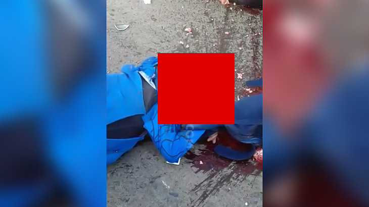 【閲覧注意】バイク事故で身体の外に飛び出してしまった心臓がまだ動いているグロ動画。