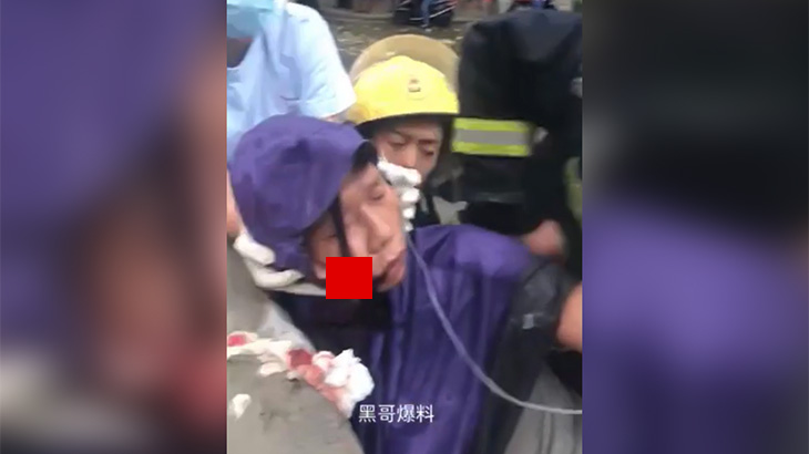 【閲覧注意】バイクで転倒した男性、右頬に鉄筋が突き刺さってしまったグロ動画。