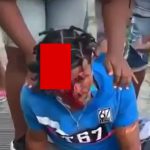 【閲覧注意】事故で頭皮がベロンとめくれてしまった男性のグロ動画。