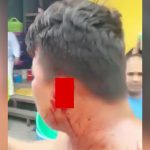 【閲覧注意】喧嘩中に左耳を噛みちぎられてしまった男のグロ動画。