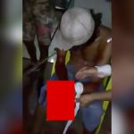 【閲覧注意】マチェーテで左手をグチャグチャにされてしまった男性のグロ動画。