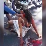 バイク事故で血を流しオッパイ丸出しの状態で意識朦朧となった女の子。