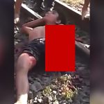 【閲覧注意】列車に轢かれて左腕と左脚を切断されてしまった男性のグロ動画。