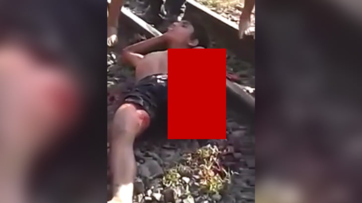 【閲覧注意】列車に轢かれて左腕と左脚を切断されてしまった男性のグロ動画。