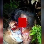 【閲覧注意】マチェーテで顔を切り裂かれた女性がまだ辛うじて生きているグロ動画。