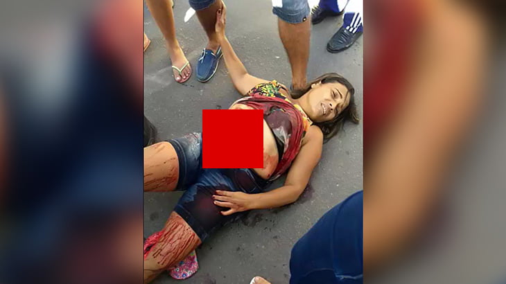 【閲覧注意】事故で腹から腸が飛び出してしまった女性のグロ動画。