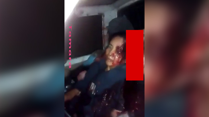 【閲覧注意】顔が潰れた男性死体に挟まれた状態で生き残った女性のグロ動画。