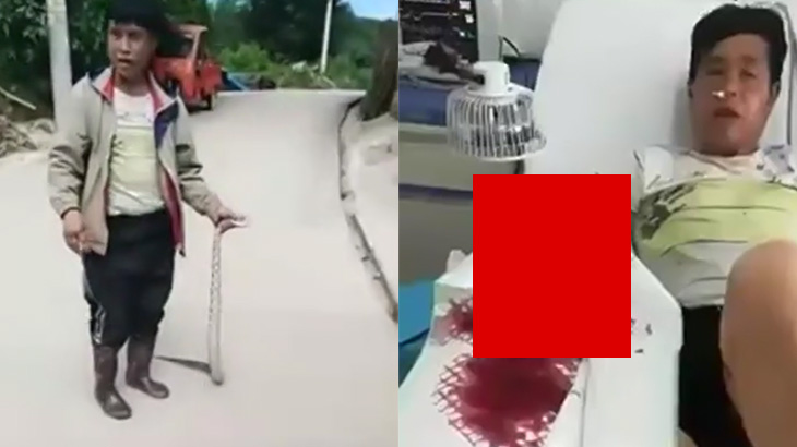 【衝撃映像】毒蛇に噛まれてしまった男性の腕、とんでもないことになってしまう･･･。