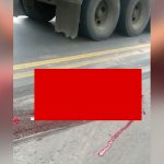 【閲覧注意】トラックに轢かれて死亡した女性の脚、あらぬ方向に曲がってしまったグロ動画。