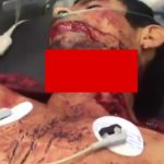 【閲覧注意】首を半分以上も切られてしまった男性を手術するグロ動画。