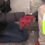 【閲覧注意】催涙手榴弾で右手が吹き飛ばされてしまったデモ参加者の男性。
