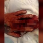 【閲覧注意】左手の中指を切断されてしまった男性のグロ動画。
