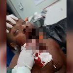 【閲覧注意】顎が無くなってしまった男性を撮影したグロ動画。