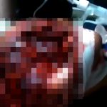 【閲覧注意】顔の右半分が破壊された女性、こんな状態でもまだ生きているグロ動画。