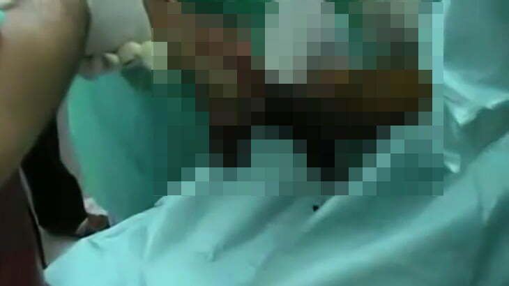 【閲覧注意】?撃を受けて右脚がグチャグチャになってしまったグロ動画。